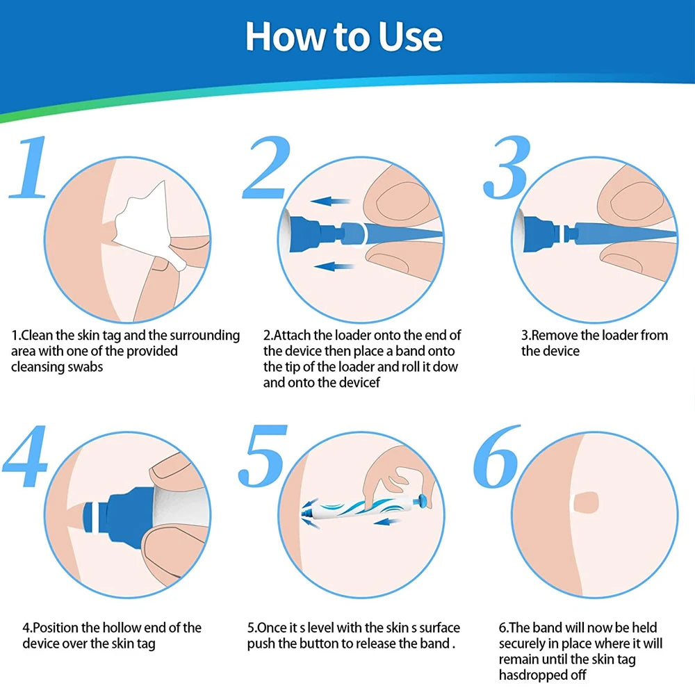 2 IN 1 Auto Micro Skin Tag Remover Device Standard
