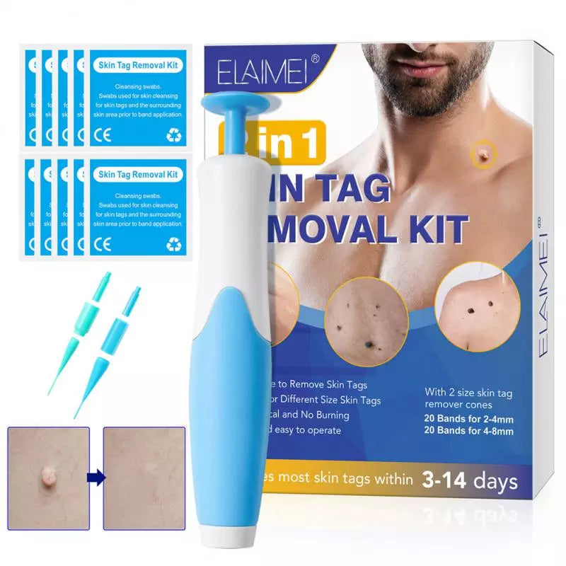 Auto Skin Tag Mole Wart Removal Kit