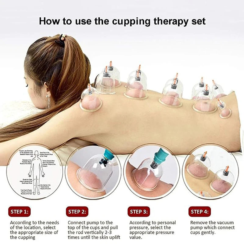 32 Cupping Therapy Massage Set