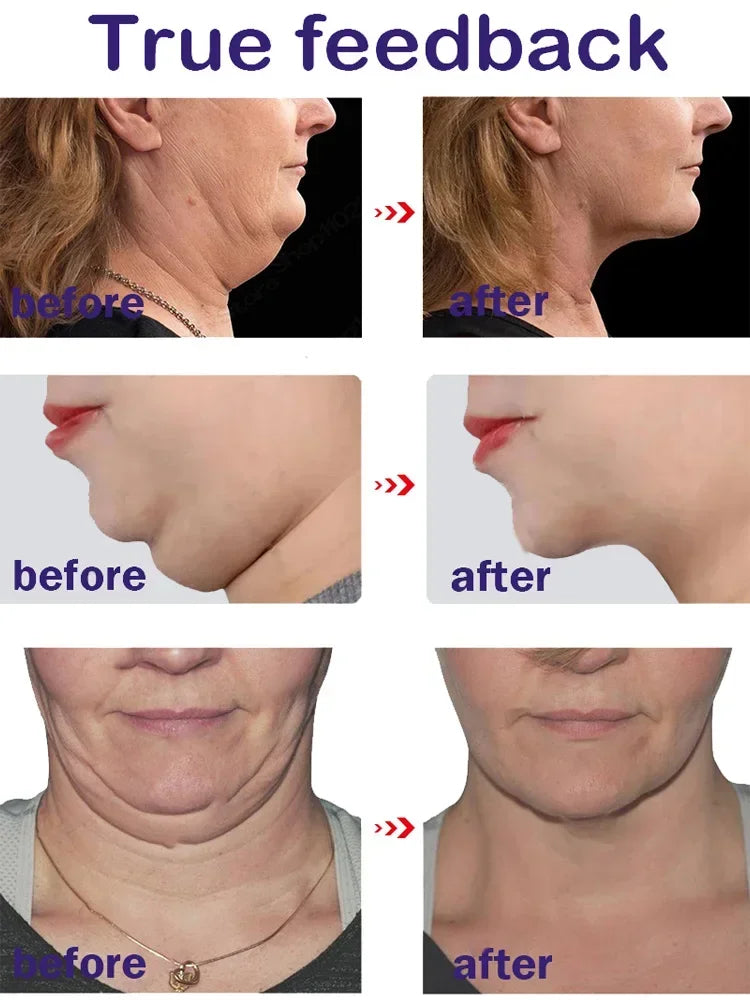 V-Shape Face Slimming Lifting Facial Cream