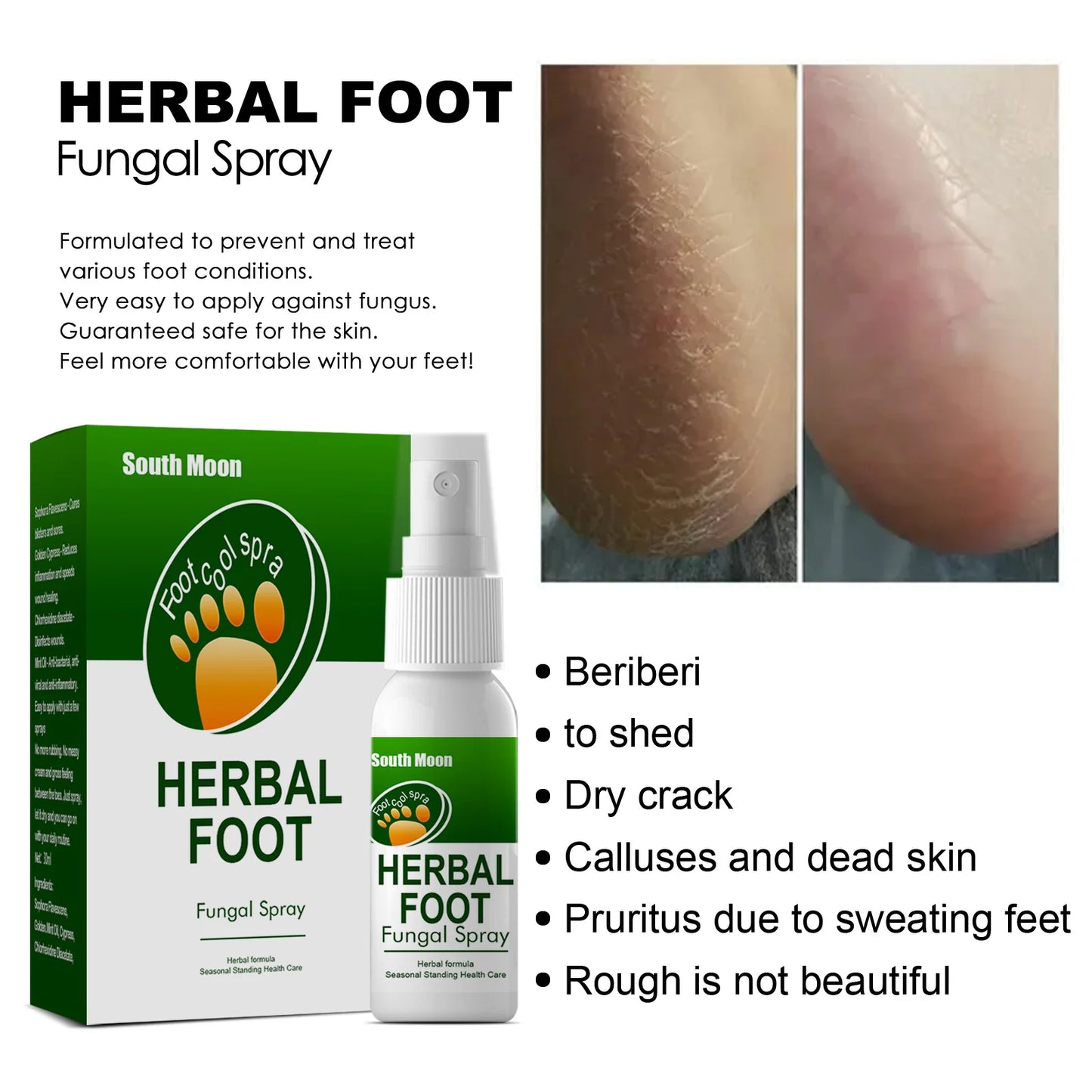 Sweaty Feet Anti-itching Spray