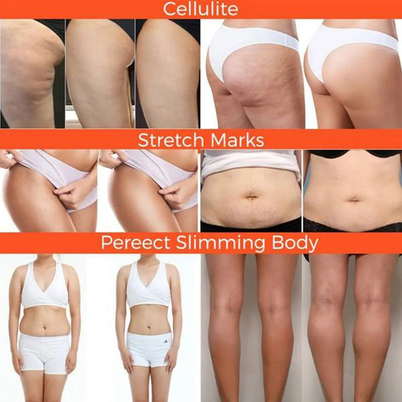 Ginger Fat Burning Cream