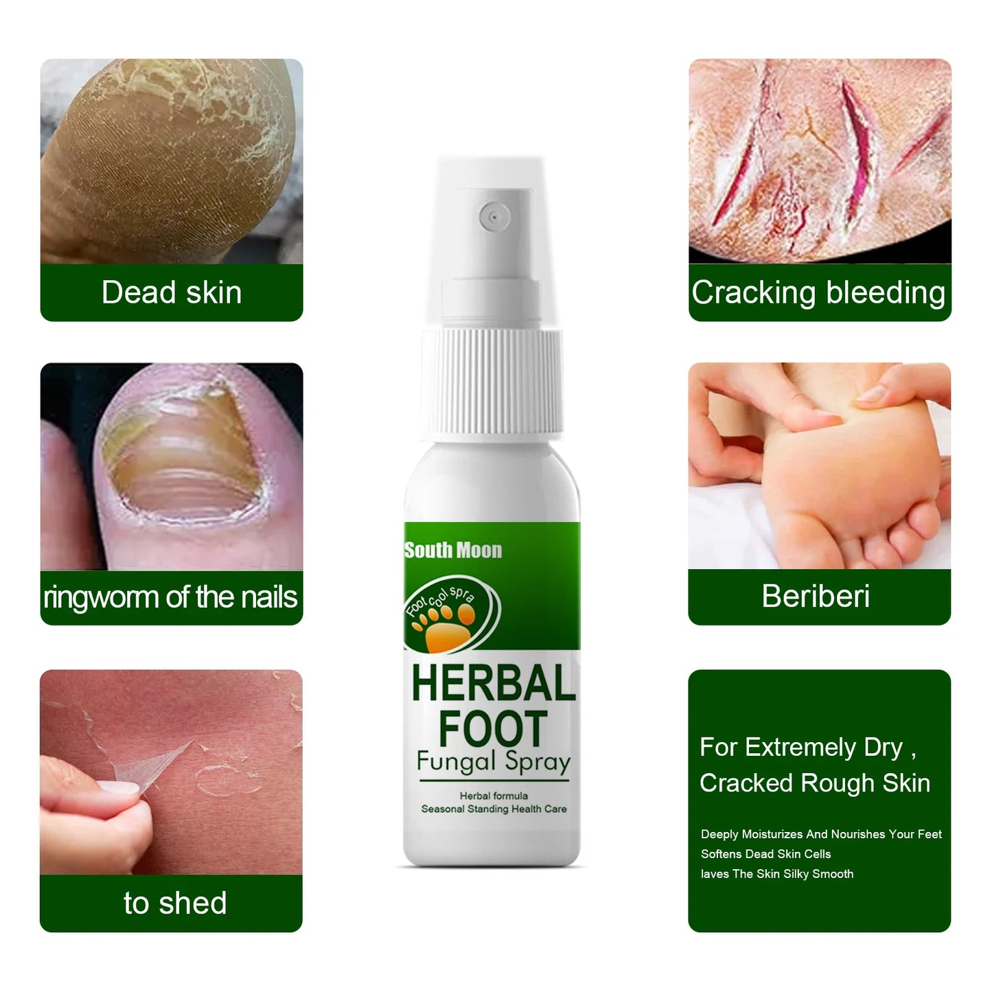 Sweaty Feet Anti-itching Spray