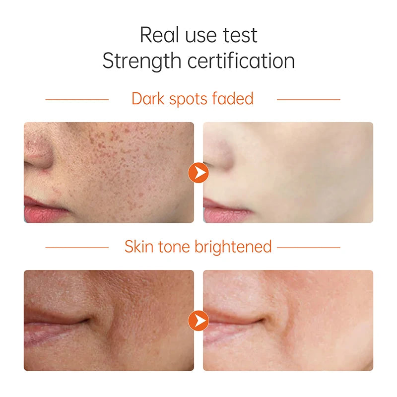 Vitamin C Serum for Face Cream Set