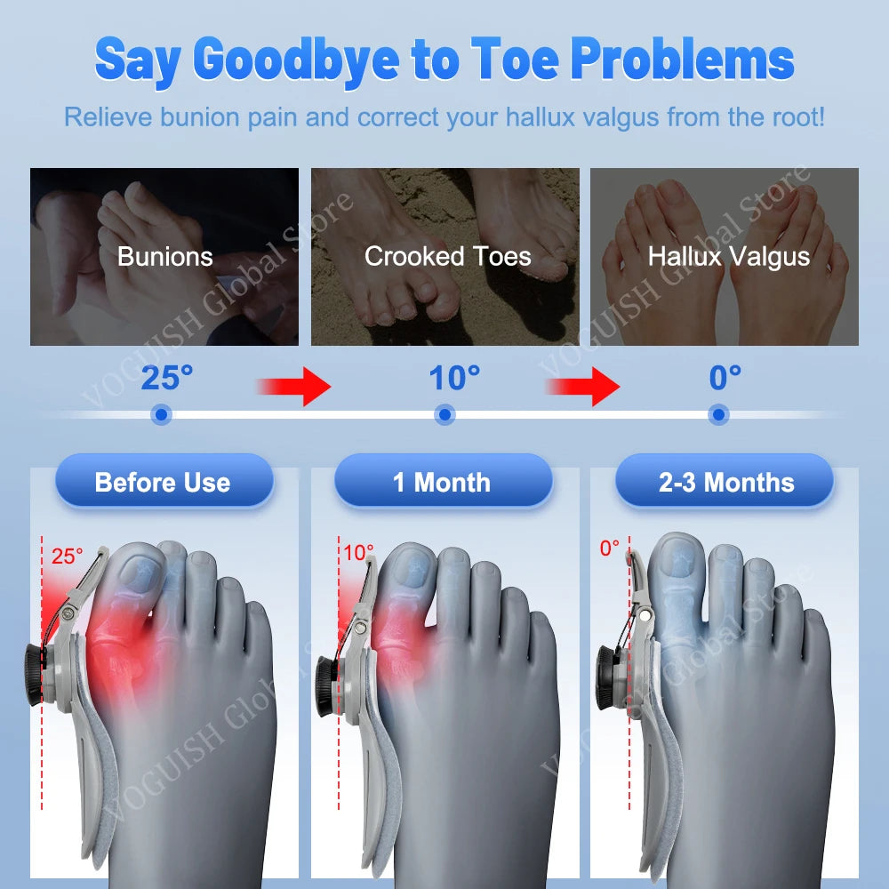 Straightener Unisex Foot Hallux Valgus Braces