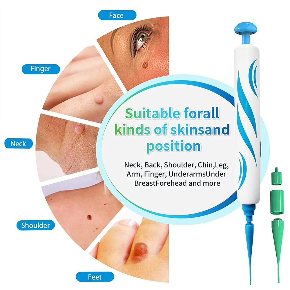 2 IN 1 Auto Micro Skin Tag Remover Device Standard