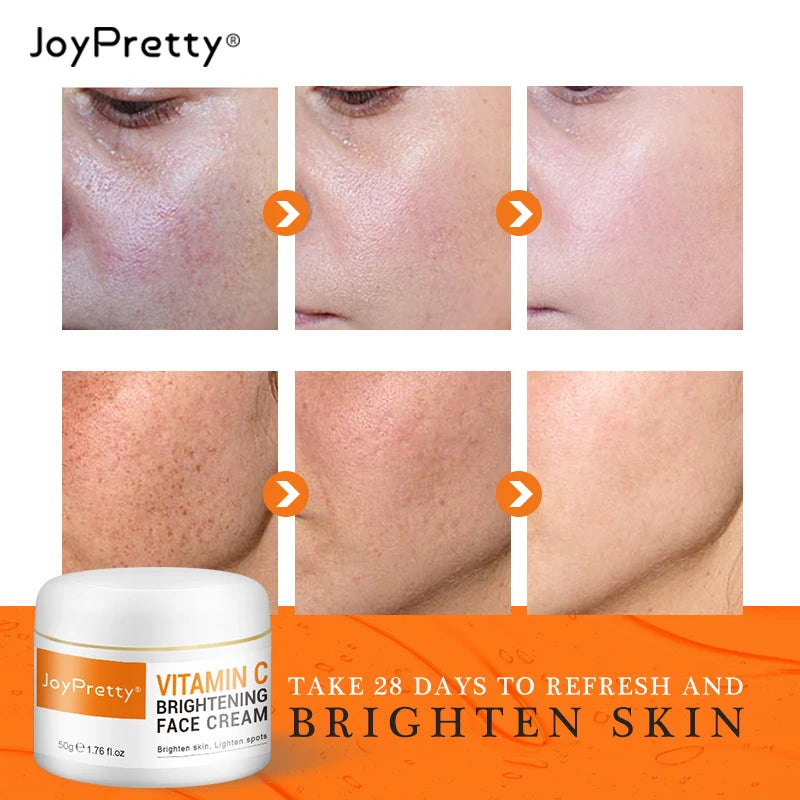 Vitamin C Serum for Face Cream Set