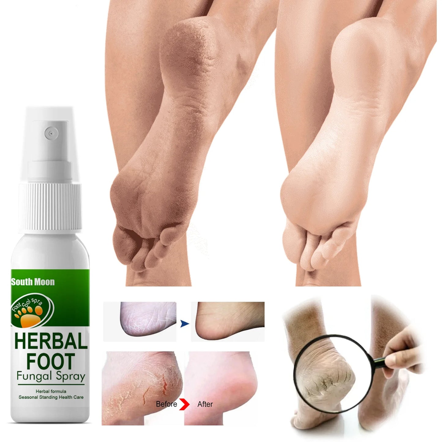 Sweaty Feet Anti-itching Spray