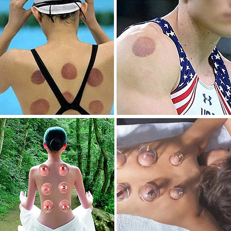 32 Cupping Therapy Massage Set