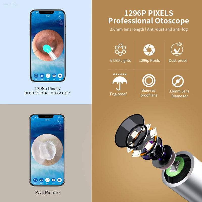 Mini Camera Health Care Ear Cleaner