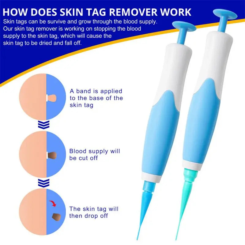 Auto Skin Tag Mole Wart Removal Kit