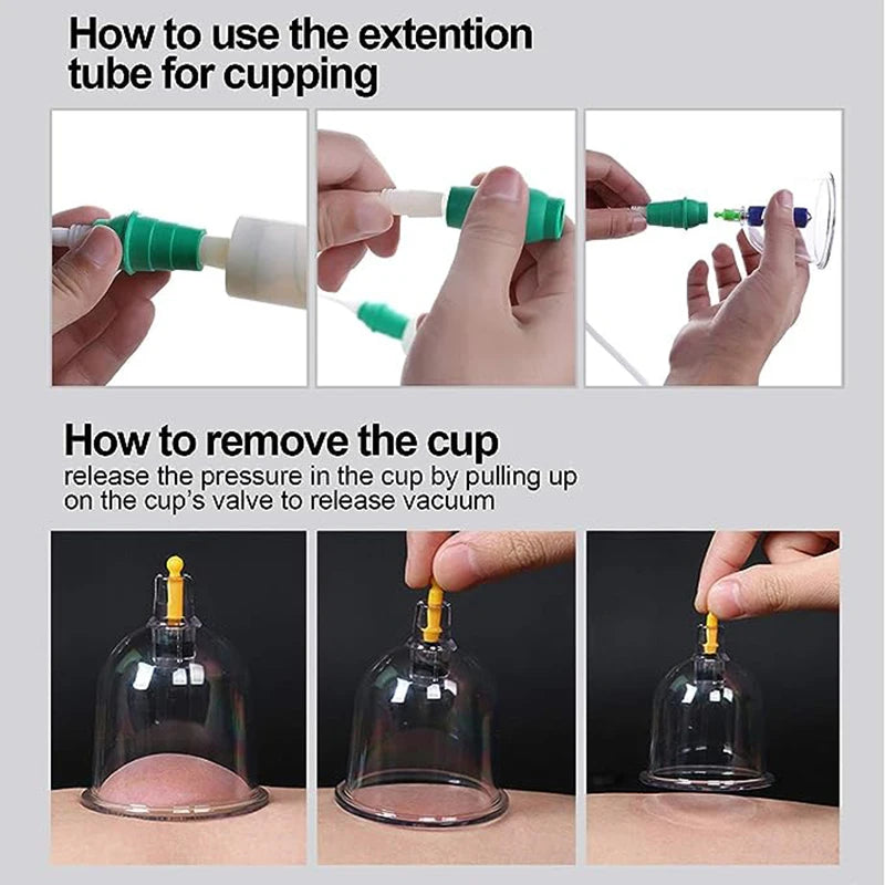 32 Cupping Therapy Massage Set