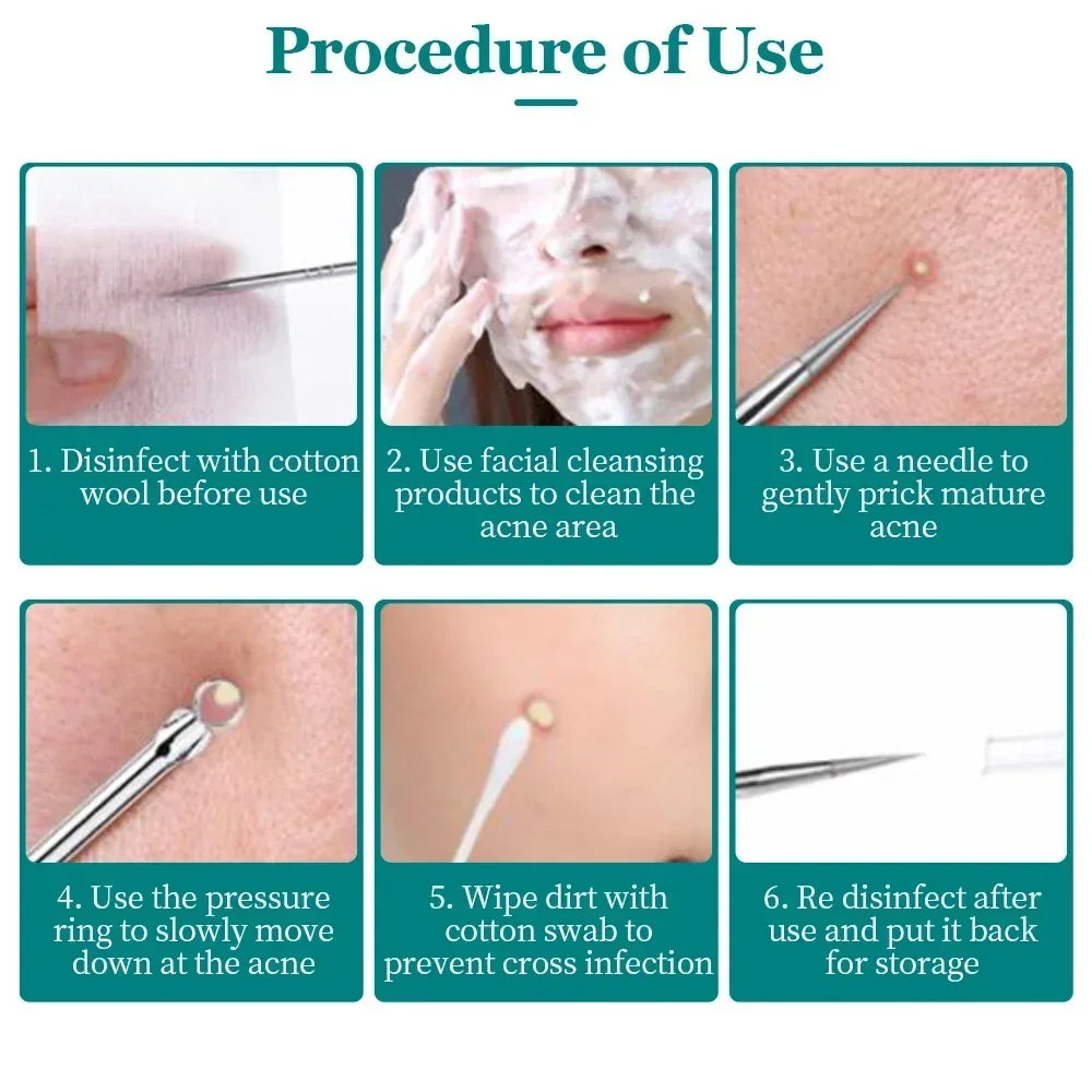 Blackhead Acne Needle